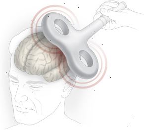 Transcranial stimulation Transcranial stimulation