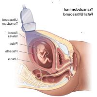 Illustration af transabdominal føtal ultralyd Illustration af transabdominal føtal ultralyd