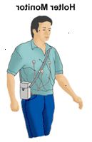 Illustration af en mand iført en Holter skærm Illustration af en mand iført en Holter skærm