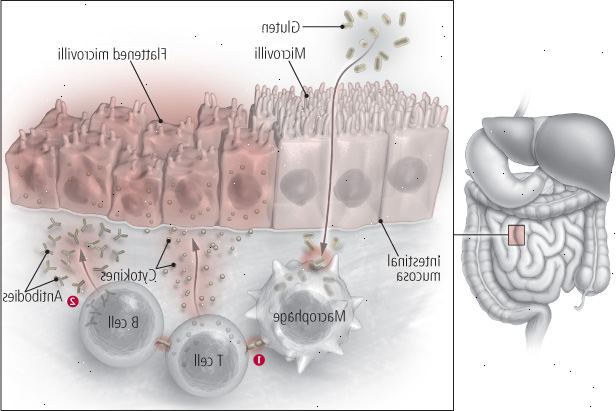 Celiace imod kornet Celiace imod kornet