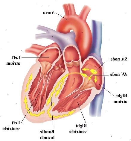 Set forfra hjerte viser atrier på toppen og hjertekamrene på bunden. Aorta er stor arterie spændende hjerte øverst. SA node og AV-knuden er i højre atrium. Grenblok nerver er i muren mellem hjertekamrene og kurve i ventrikel vægge. Signaler fra AV-knuden rejse til AV-knuden og ind bundt grene. Set forfra hjerte viser atrier på toppen og hjertekamrene på bunden. Aorta er stor arterie spændende hjerte øverst. SA node og AV-knuden er i højre atrium. Grenblok nerver er i muren mellem hjertekamrene og kurve i ventrikel vægge. Signaler fra AV-knuden rejse til AV-knuden og ind bundt grene.