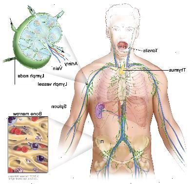 Lymfesystemet; Tegningen viser lymfekar og lymfeknuder organer, herunder lymfeknuder, tonsiller, thymus, milt og knoglemarv. En indsatte viser den indvendige struktur af en lymfeknude og de ledsagende lymfekar med pile viser, hvordan lymfeknuder (klar væske) bevæger sig ind og ud af lymfeknude. En anden indsatte viser et nærbillede af knoglemarv med blodceller. Lymfesystemet; Tegningen viser lymfekar og lymfeknuder organer, herunder lymfeknuder, tonsiller, thymus, milt og knoglemarv. En indsatte viser den indvendige struktur af en lymfeknude og de ledsagende lymfekar med pile viser, hvordan lymfeknuder (klar væske) bevæger sig ind og ud af lymfeknude. En anden indsatte viser et nærbillede af knoglemarv med blodceller.