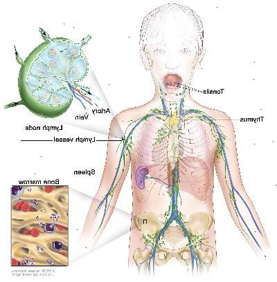 Lymfesystemet; Tegningen viser lymfekar og lymfeknuder organer, herunder lymfeknuder, tonsiller, thymus, milt og knoglemarv. En indsatte viser den indvendige struktur af en lymfeknude og de ledsagende lymfekar med pile viser, hvordan lymfeknuder (klar væske) bevæger sig ind og ud af lymfeknude. En anden indsatte viser et nærbillede af knoglemarv med blodceller. Lymfesystemet; Tegningen viser lymfekar og lymfeknuder organer, herunder lymfeknuder, tonsiller, thymus, milt og knoglemarv. En indsatte viser den indvendige struktur af en lymfeknude og de ledsagende lymfekar med pile viser, hvordan lymfeknuder (klar væske) bevæger sig ind og ud af lymfeknude. En anden indsatte viser et nærbillede af knoglemarv med blodceller.