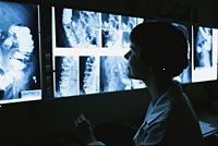 Billede af en læge, ser barium x-ray film Billede af en læge, ser barium x-ray film