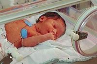 Billede af en baby i neonatal intensivafdeling