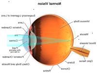 Illustration viser normalt syn Illustration viser normalt syn