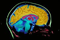 Et billede af en MRI scanning af hjernen film Et billede af en MRI scanning af hjernen film