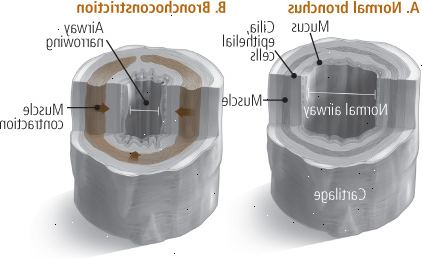Bronkokonstriktion Bronkokonstriktion