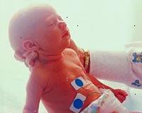 Billede af en nyfødt i neonatal intensivafdeling Billede af en nyfødt i neonatal intensivafdeling
