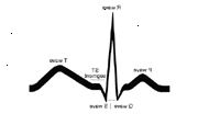 Illustration af en grundlæggende EKG sporing Illustration af en grundlæggende EKG sporing